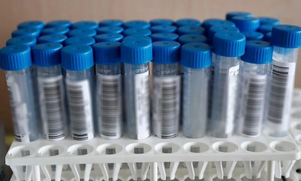 Γαλλία: Στη "φόρα" τα προσωπικά δεδομένα 700.000 ανθρώπων που είχαν υποβληθεί σε τεστ κορονοϊού
